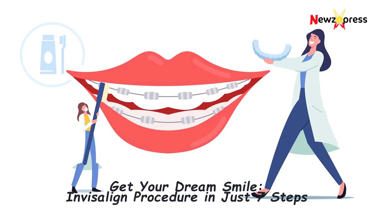 Step-by-Step Guide to the Invisalign Procedure