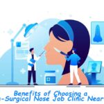 Benefits of Choosing a Non-Surgical Nose Job Clinic Near Me