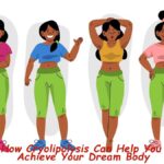 How Cryolipolysis Can Help You Achieve Your Dream Body